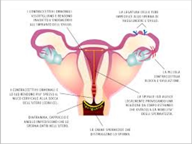 Schema di spirale in utero